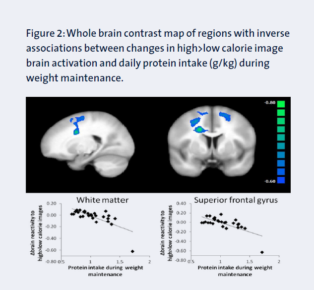 Brain contrast - nutrition research