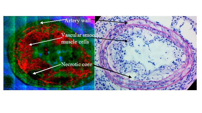 Lipid-cartography-of-mouse-atherosclerotic-plaques-by-ToF-SIMS-imaging-mass-spectrometry