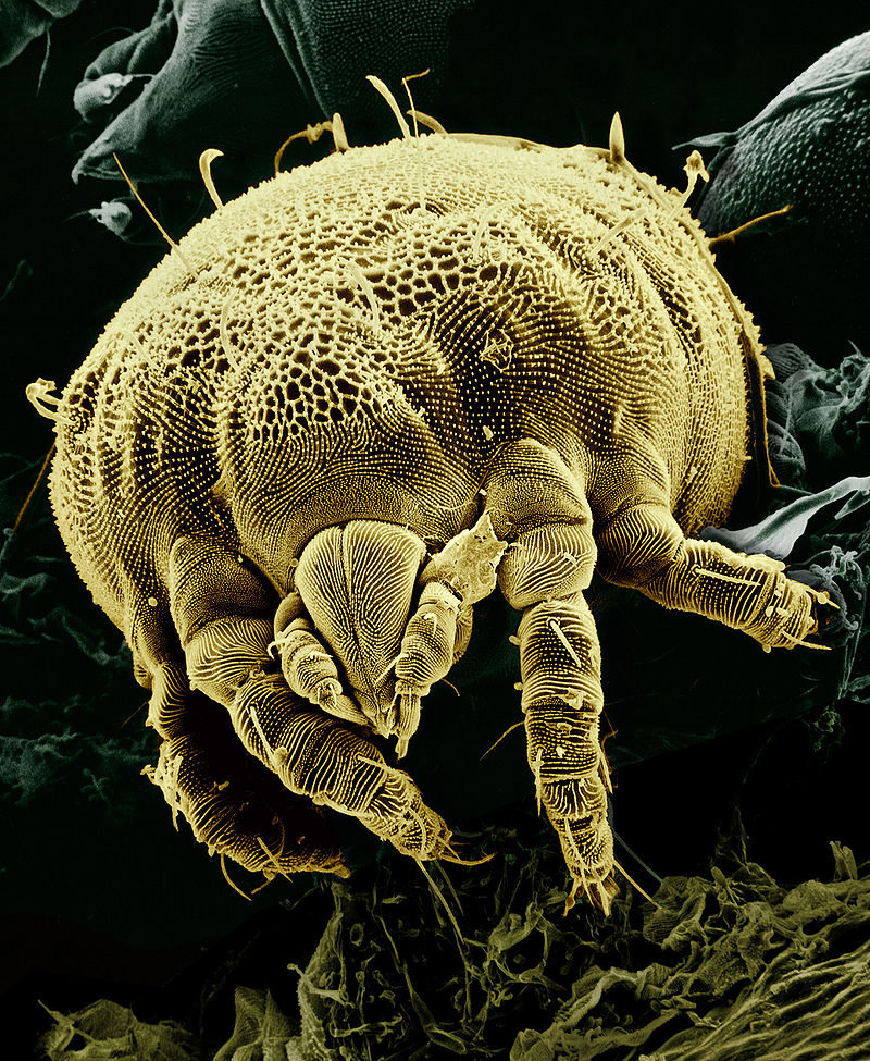 A picture of a micro organism.