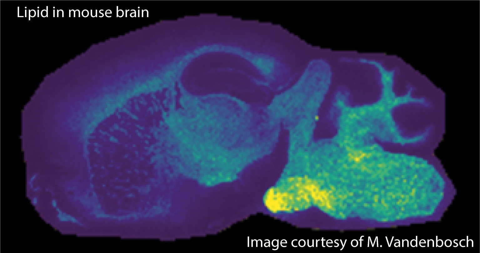 MSI Lipid in mouse brain