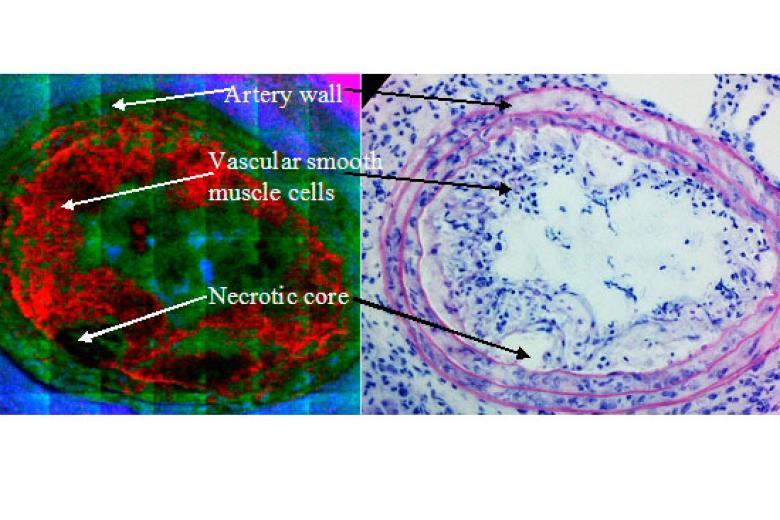 Lipid-cartography-of-mouse-atherosclerotic-plaques-by-ToF-SIMS-imaging-mass-spectrometry