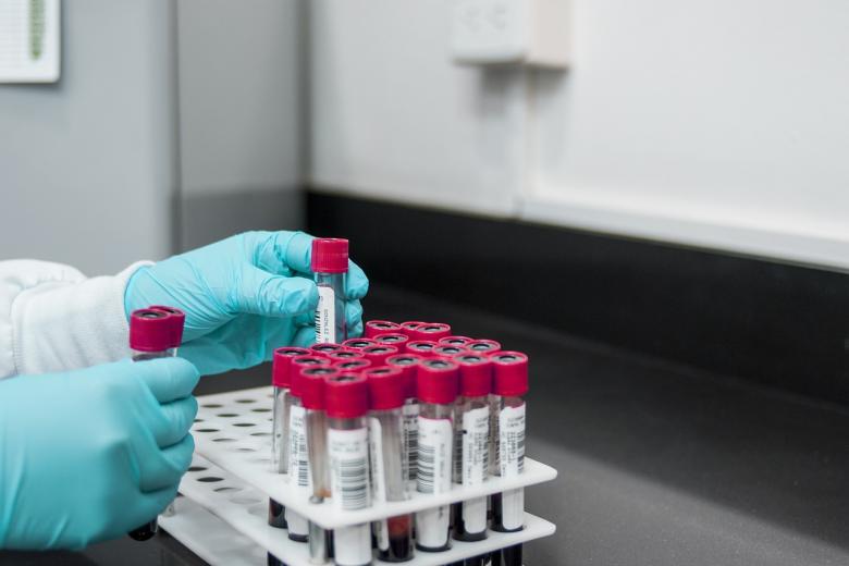 Bloedmonsters in lab